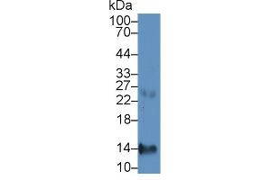 Detection of CXCL7 in Human Liver lysate using Monoclonal Antibody to Chemokine (C-X-C motif) ligand 7 ( CXCL7) (CXCL7 antibody  (AA 59-128))