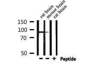 Western blot analysis of extracts from rat rain,mouse brain , using USP13 Antibody. (USP13 antibody  (C-Term))