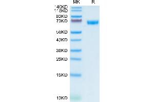 Human CD200 on Tris-Bis PAGE under reduced condition. (CD200 Protein (CD200) (AA 31-232) (Fc Tag))