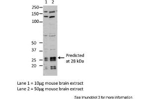 Sample Type: Lane1 = 10ug mouse brain extractLane 2 = 50ug mouse brain extractPrimary Antibody Dilution: Anti-EIF4E 1:1000Submitted By: Dr. (EIF4E antibody  (C-Term))