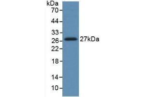 Detection of Recombinant HGF, Human using Monoclonal Antibody to Hepatocyte Growth Factor (HGF) (HGF antibody  (AA 495-728))