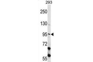 Western Blotting (WB) image for anti-Epithelial Cell Transforming Sequence 2 Oncogene (ECT2) antibody (ABIN2998212)