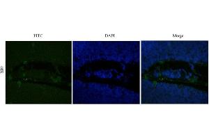 Immunofluorescent staining of rat thymus using anti-CD25 antibody   Formaldehyde-fixed rat thymus slices were stained with  at 5 µg/ml and detected with a FITC-conjugated secondary antibody. (Recombinant IL2RA (Basiliximab Biosimilar) antibody)