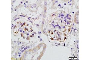Formalin-fixed and paraffin embedded rat kidney tissue with Anti-Megsin Polyclonal Antibody, Unconjugated  at 1:200, followed by conjugation to the secondary antibody and DAB staining