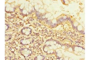 Immunohistochemistry of paraffin-embedded human small intestine tissue using ABIN7161966 at dilution of 1:100 (Nucleolar Protein 1 (NOL1) (AA 1-210) antibody)