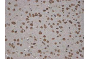 Zinedin Immunohistochemistry. (STRN4 antibody  (Internal Region))