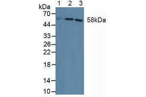Figure. (DKC1 antibody  (AA 298-465))