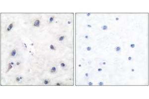 Immunohistochemistry analysis of paraffin-embedded human brain tissue, using DARPP-32 (Ab-34) Antibody. (DARPP32 antibody  (AA 18-67))