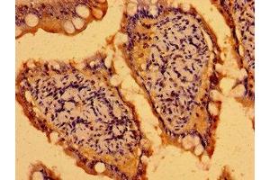 Immunohistochemistry of paraffin-embedded human small intestine tissue using ABIN7165166 at dilution of 1:100 (C19ORF12 antibody  (AA 65-104))