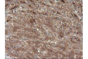 Image no. 4 for anti-Mitogen-Activated Protein Kinase Kinase 3 (MAP2K3) antibody (ABIN1499401)