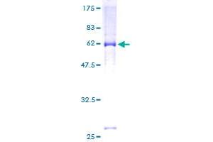 Image no. 1 for Potassium Voltage-Gated Channel, KQT-Like Subfamily, Member 2 (KCNQ2) (AA 1-393) protein (GST tag) (ABIN1308478) (KCNQ2 Protein (AA 1-393) (GST tag))