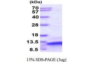SDS-PAGE (SDS) image for Parathyroid Hormone (PTH) protein (ABIN666842) (PTH Protein)