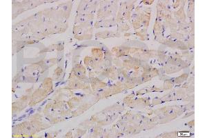 Formalin-fixed and paraffin embedded rat heart labeled with Anti-factor V Polyclonal Antibody, Unconjugated (ABIN736776) at 1:200 followed by conjugation to the secondary antibody and DAB staining. (Factor 5 (AA 301-400) antibody)