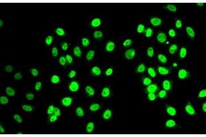 Immunofluorescence analysis of MCF-7 cells using REST Polyclonal Antibody (REST antibody)