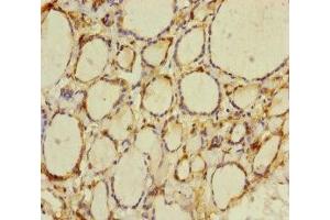 Immunohistochemistry of paraffin-embedded human thyroid tissue using ABIN7165198 at dilution of 1:100 (CRBN antibody  (AA 1-280))