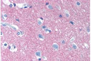 Human Brain, Cortex (formalin-fixed, paraffin-embedded) stained with NCAM1 antibody ABIN239830 at 10 µg/ml followed by biotinylated anti-mouse IgG secondary antibody ABIN481714, alkaline phosphatase-streptavidin and chromogen. (CD56 antibody)