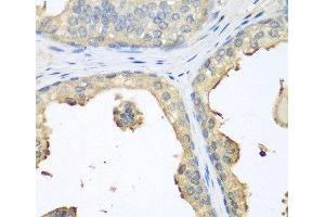Immunohistochemistry of paraffin-embedded Human prostate using GPI Polyclonal Antibody at dilution of 1:100 (40x lens). (GPI antibody)
