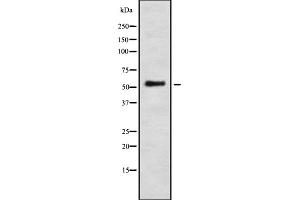 Western blot analysis IFI-56K using LOVO whole cell lysates (IFIT1 antibody  (Internal Region))