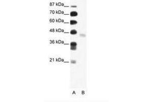 Image no. 1 for anti-FEZ Family Zinc Finger 2 (FEZF2) (N-Term) antibody (ABIN202569) (FEZF2 antibody  (N-Term))