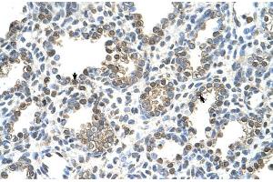 Immunohistochemistry (IHC) image for anti-Thiosulfate Sulfurtransferase (Rhodanese) (TST) (Middle Region) antibody (ABIN2777154)