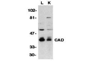 Western Blotting (WB) image for anti-Carbamoyl-Phosphate Synthetase 2, Aspartate Transcarbamylase, and Dihydroorotase (CAD) (C-Term) antibody (ABIN1030307) (CAD antibody  (C-Term))