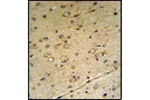 Immunohistochemistry analysis in Formalin Fixed, Paraffin Embedded Mouse Brain tissue using SLC39A3 antibody (Center) followed by peroxidase conjugation of the secondary antibody and DAB staining. (SLC39A3 antibody  (Middle Region))