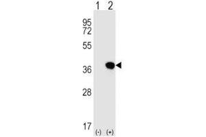 Western blot analysis of HLA-G antibody and 293 cell lysate either nontransfected (Lane 1) or transiently transfected (2) with the HLA-G gene. (HLAG antibody  (AA 62-89))
