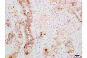 Formalin-fixed and paraffin embedded mouse thyroid labeled with Anti-Secretin receptor Polyclonal Antibody, Unconjugated (ABIN724730) at 1:200 followed by conjugation to the secondary antibody and DAB staining