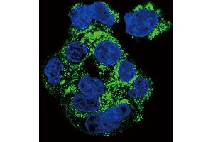 Confocal immunofluorescent analysis of CSF1R Antibody (ABIN652364 and ABIN2841700) with HepG2 cell followed by Alexa Fluor 488-conjugated goat anti-rabbit lgG (green). (CSF1R antibody)