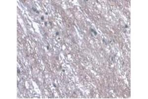 Detection of LRG1 in Rat Spinal Cord Tissue using Monoclonal Antibody to Leucine Rich Alpha-2-Glycoprotein 1 (LRG1) (LRG1 antibody  (AA 154-332))