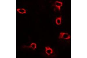 Immunofluorescent analysis of ACP5 staining in U2OS cells. (ACP5 antibody)