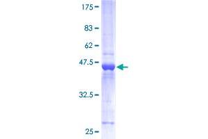 Hippocalcin Protein (HPCA) (AA 1-193) (GST tag)