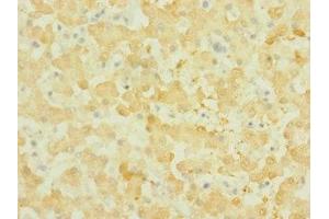 Immunohistochemistry of paraffin-embedded human liver tissue using ABIN7161009 at dilution of 1:100 (NOX3 antibody  (AA 223-395))