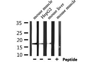 Western blot analysis of extracts from mouse muscle ,HepG2,mouse liver, using KLRC2/4 Antibody. (KLRC2/4 antibody)