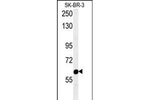 RADIL Antibody (C-term) (ABIN654195 and ABIN2844045) western blot analysis in SK-BR-3 cell line lysates (15 μg/lane).