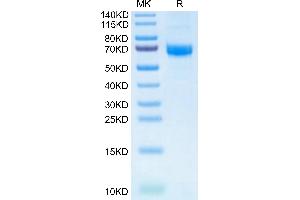 Human Alkaline phosphatase on Tris-Bis PAGE under reduced condition.