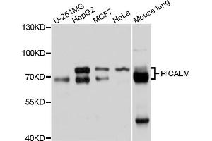 Western blot analysis of extracts of various cell lines, using PICALM antibody (ABIN4904757) at 1:1000 dilution. (PICALM antibody)