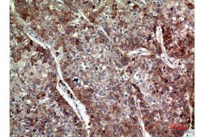 Immunohistochemistry (IHC) analysis of paraffin-embedded Human Lung, antibody was diluted at 1:100. (IL-24 antibody  (Internal Region))