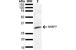 Western blot analysis of Rat kidney lysate showing detection of ~28 kDa MMP7 protein using Rabbit Anti-MMP7 Polyclonal Antibody (ABIN5651226).
