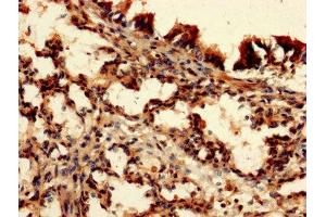 IHC image of ABIN7149549 diluted at 1:150 and staining in paraffin-embedded human lung tissue performed on a Leica BondTM system. (DAP antibody  (AA 2-102))