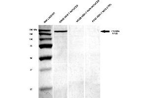 Western Blot analysis of Human HEK-T lysates showing detection of GluN2B/NR2B protein using Mouse Anti-GluN2B/NR2B Monoclonal Antibody, Clone S59-36 . (GRIN2B antibody  (AA 20-271) (APC))