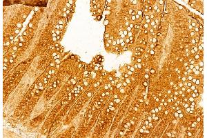 ABIN6263928 and ABIN6268733 at 1/100 staining Rat colon tissue by IHC-P.