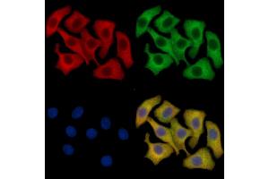 Fas Ligand Mouse Monoclonal Antibody staining HepG2 cells by IF/ICC.