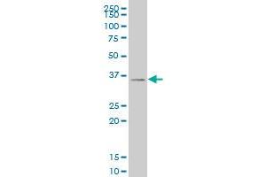 SIX3 monoclonal antibody (M04), clone 1A2 Western Blot analysis of SIX3 expression in 293 . (SIX3 antibody  (AA 273-332))