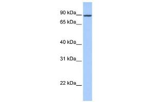 WB Suggested Anti-ZNF16 Antibody Titration:  0. (ZNF16 antibody  (N-Term))