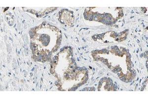 ABIN6268698 at 1/100 staining Human prostate tissue by IHC-P. (CD51 antibody  (Internal Region))