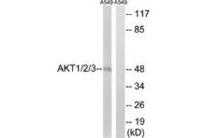 Western blot analysis of extracts from A549 cells, using AKT1/2/3 (Ab-315/316/312) Antibody. (AKT 1/2/3 antibody  (AA 281-330))