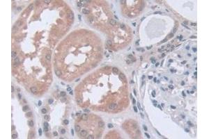 Immunohistochemistry (IHC) image for anti-Stress-Induced-phosphoprotein 1 (STIP1) (AA 1-169) antibody (ABIN7436411)