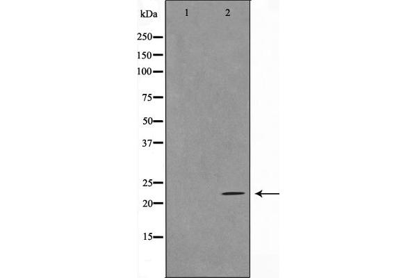 TNFSF13 antibody  (Internal Region)