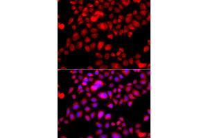 Immunofluorescence analysis of A549 cell using ETFA antibody. (ETFA antibody)